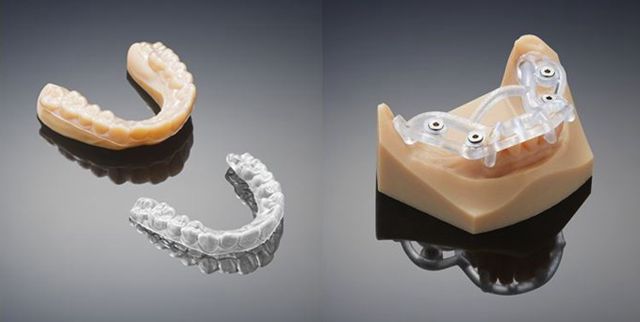3D打印牙模.jpg